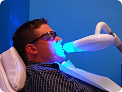 SmileLABS of Charleston, get your teeth noticeably whiter